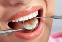Varginha terá Campanha de Prevenção do Câncer Bucal nesta semana