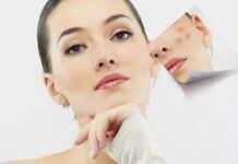 Mitos e verdades da Isotretinoína, medicamento para acne