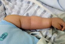 Pais suspeitos de agredir bebê de seis meses serão indiciados Bebe agredido