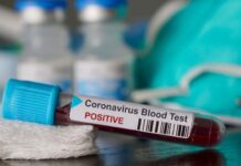Coronavírus: Varginha tem 10 casos suspeitos sendo monitorados Coronavírus
