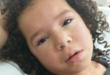 Acidente com cobra: menina que foi picada tem alta e família pede ajuda Menina