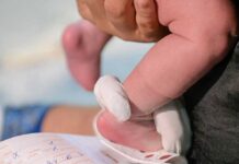 Laboratório deve indenizar família de bebê que teve o pé queimado Teste do pezinho
