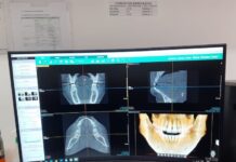 Prefeitura de Varginha inaugura Tomógrafo Odontológico no Cento de Especialidades Odontológicas do município Tomógrafo Odontológico tela