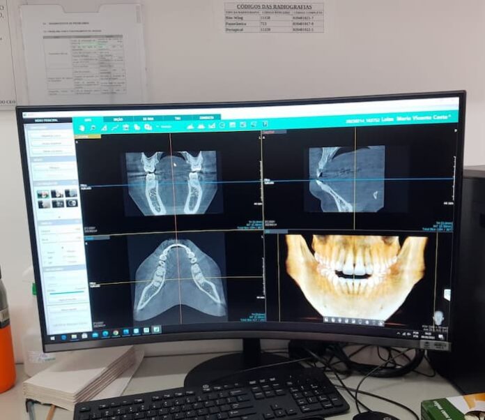 Tomógrafo Odontológico tela Tomógrafo Odontológico tela